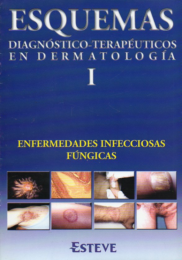 ESQUEMAS DIAGNSTICO-TERAPUTICOS EN DERMATOLOGA. I. Enfermedades infecciosas fngicas.