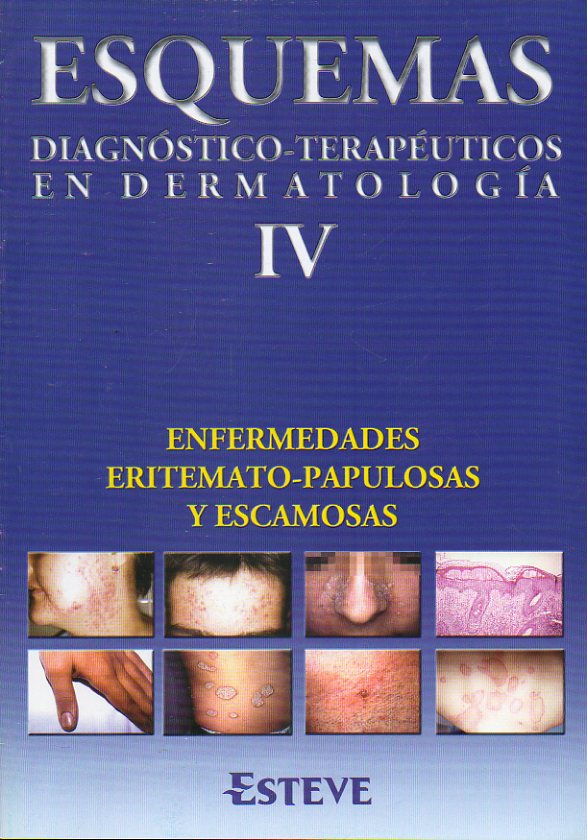 ESQUEMAS DIAGNSTICO-TERAPUTICOS EN DERMATOLOGA. IV. Enfermedades eritemato-papulosas y escamosas.